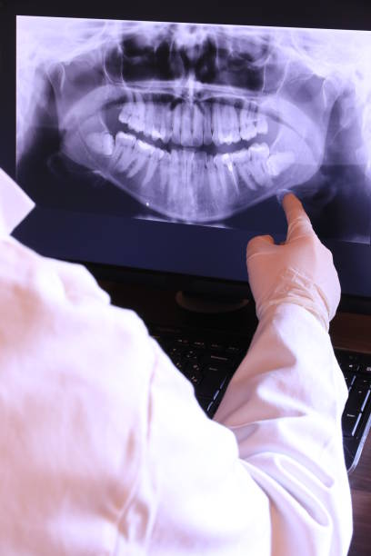 Best Emergency Treatment for Dental Infections or Abscesses in West Bradenton, FL